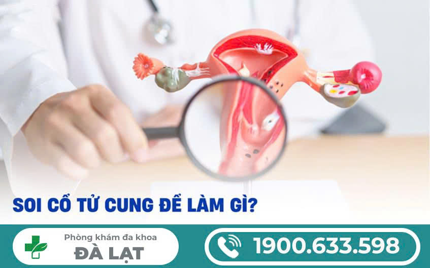 Hình ảnh minh họa